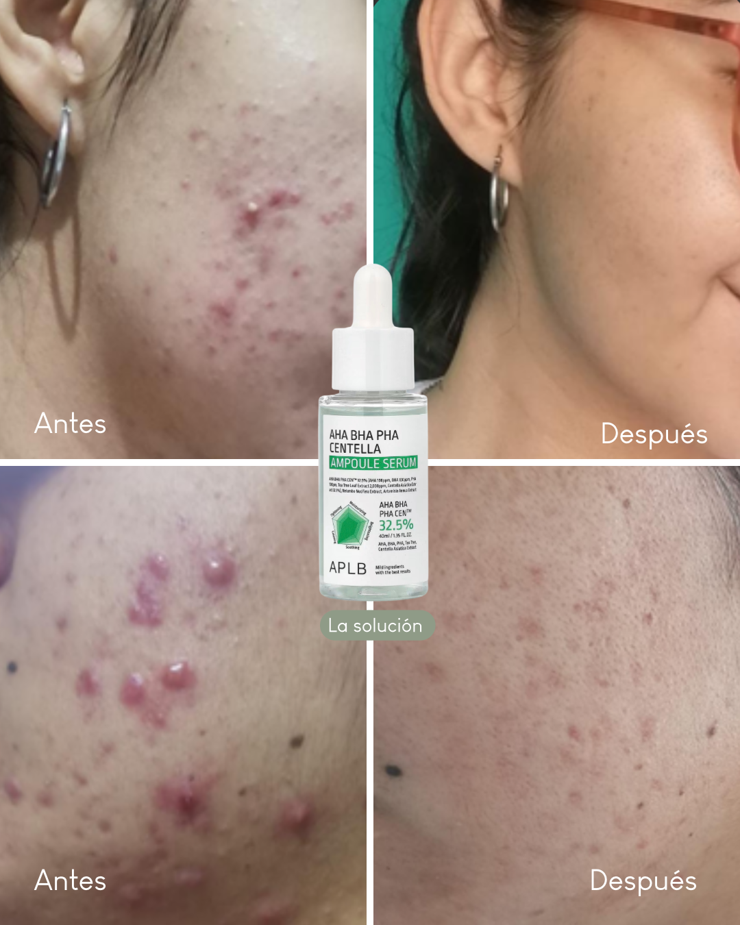 APLB AHA BHA PHA AMPOULE SERUM CENTELLA