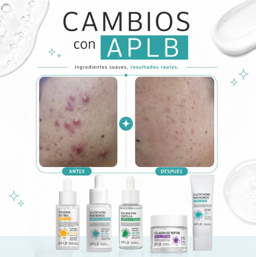 APLB AHA BHA PHA AMPOULE SERUM CENTELLA