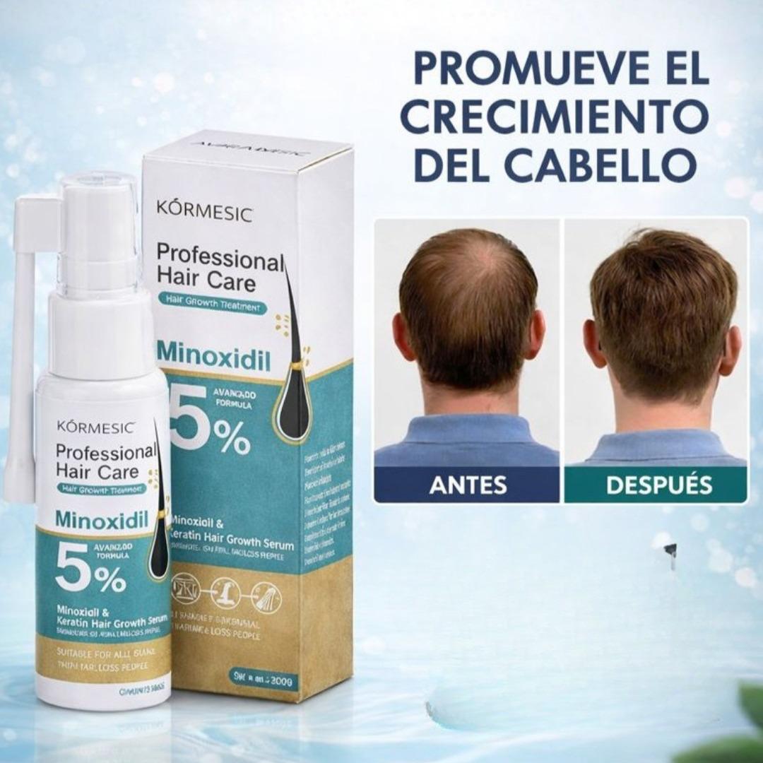 Spray Minoxidil